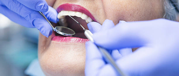 Best Emergency Treatment for Toothache in Nazareth College, NY